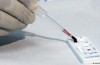 Tropical medicine expert: “Zika-Virus not with HIV”similar to