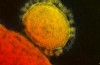 MERS-Virus en Arabie Saoudite à la Hausse