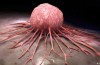 Mots-clés: Comment naît le Cancer?