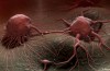 Con Virus contro le cellule Tumorali