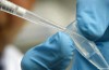 Il virus del morbillo in che posto?