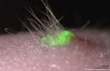 I Capelli e la pelle da cellule Staminali
